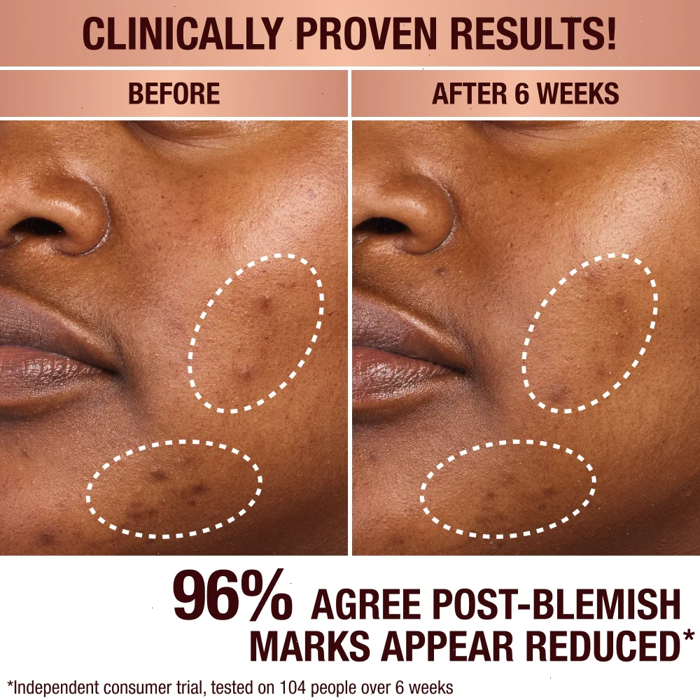 DARK SPOT SERUM & MINI CHARLOTTE’S MAGIC CREAM DUO - SKINCARE KIT - Image 4