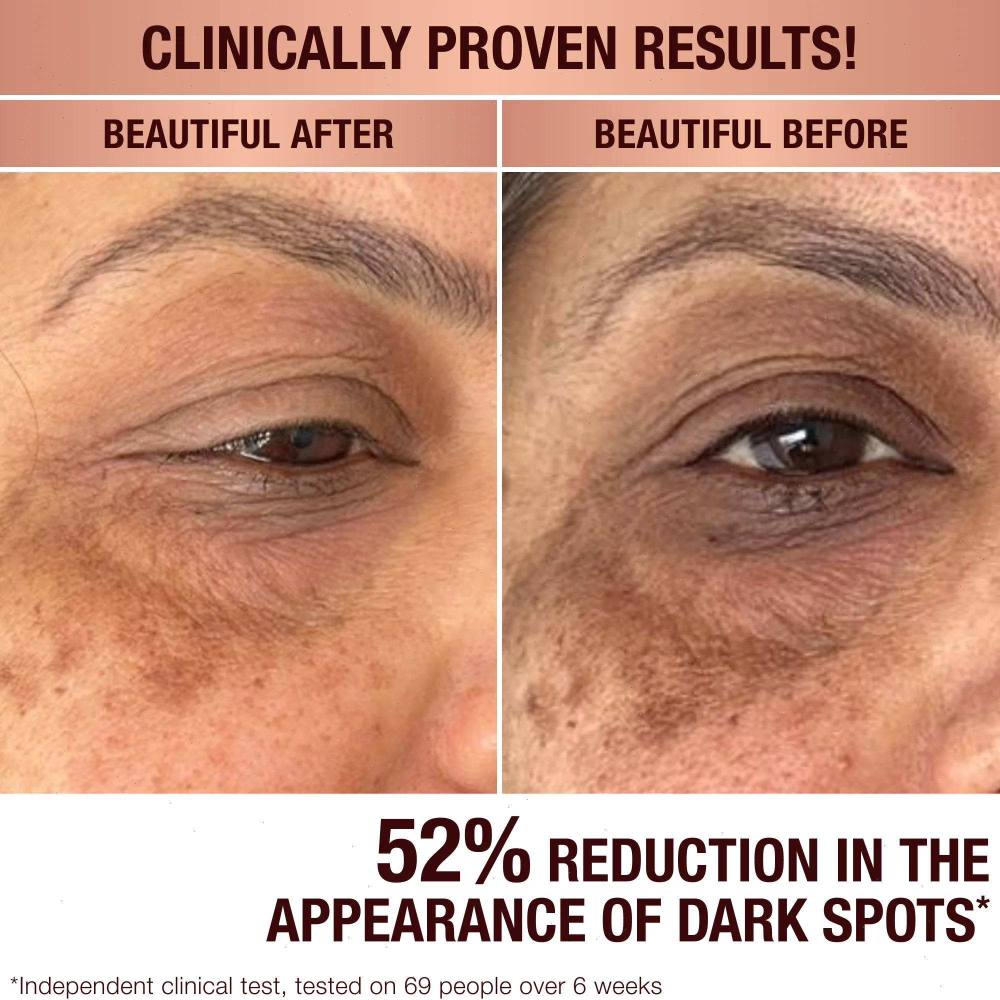 DARK SPOT CORRECTING INVISIBLE UV DUO - SKINCARE KIT - Image 3